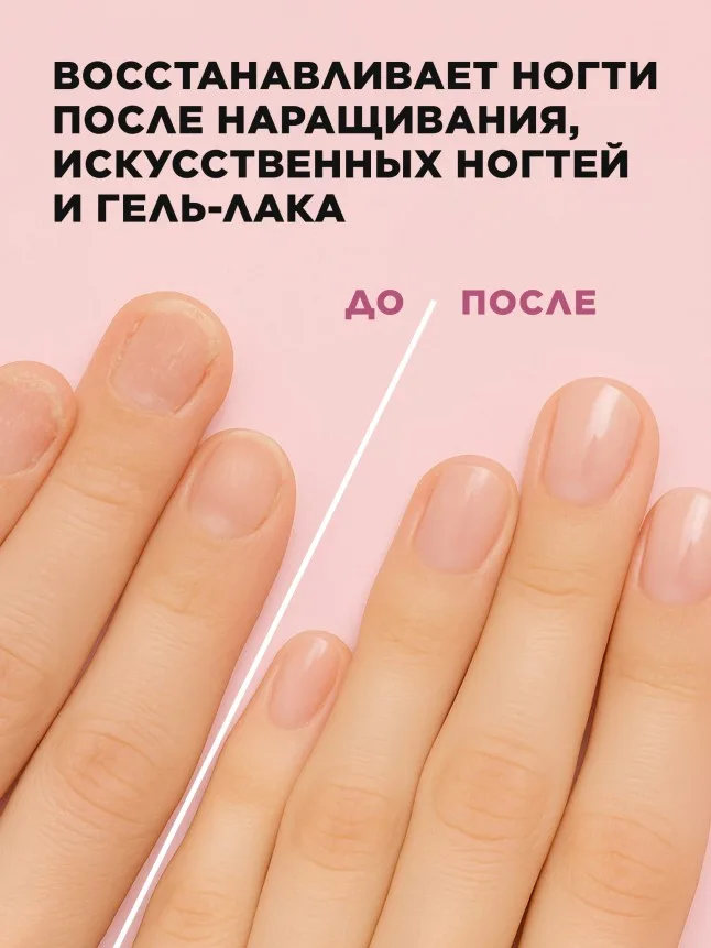 Восстанавливающее покрытие для сильно поврежденных ногтей SOS Restore