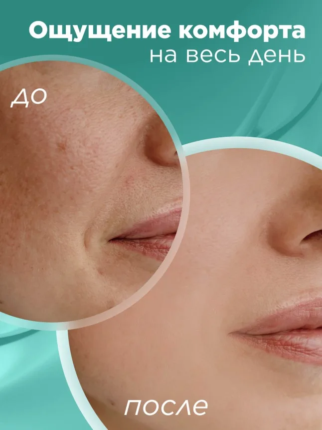 Гиалуроновый увлажняющий дневной крем для лица HyaluronCa